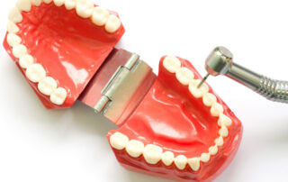 A model of teeth with a dental handpiece resting on top of it.