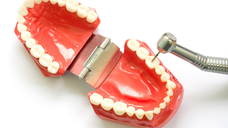 A model of teeth with a dental handpiece resting on top of it.