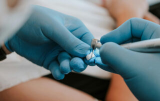 A dentist uses a high-speed dental handpiece to work on a replacement tooth.